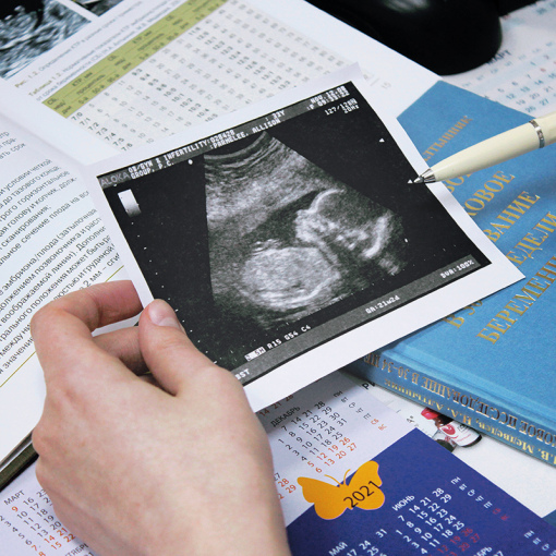 Зачем нужно делать УЗИ во время беременности?