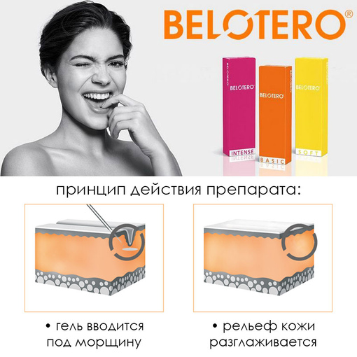 Belotero (Белотеро) – линейка филлеров на основе гиалуроновой кислоты