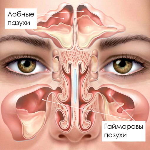 Конусно-лучевая томография (КЛКТ) пазух носа