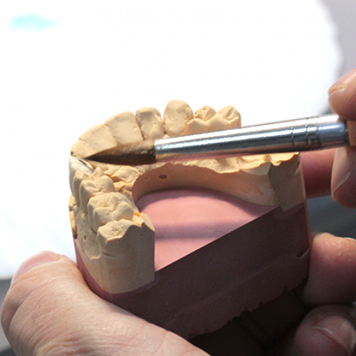 Из чего делают металлокерамические коронки и мосты для зубов