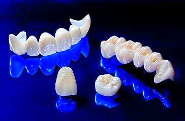 5. Установка зубной реставрации
