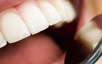 Рекомендации после удаления зуба