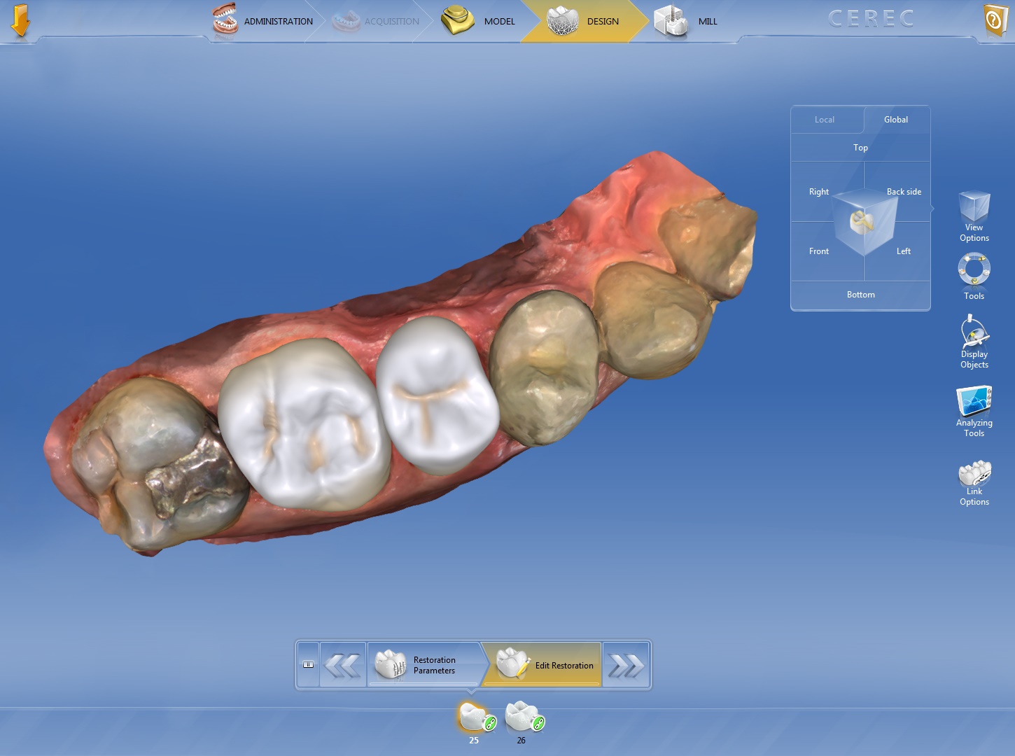 Коронки и вкладки по технологии CEREC 3D по доступной цене.